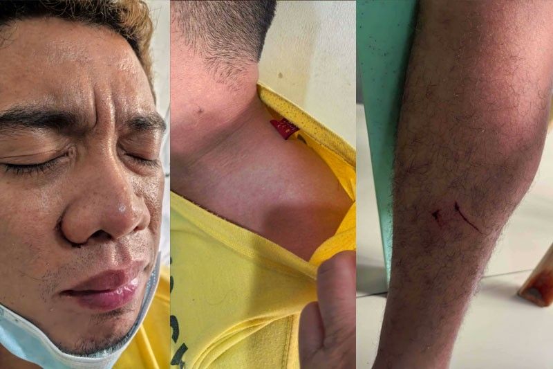 Parak inutas, itinapon sa septic tank! | Pilipino Star Ngayon