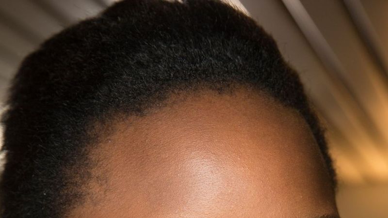 Best Exfoliator For Black Skin | British Vogue | British Vogue
