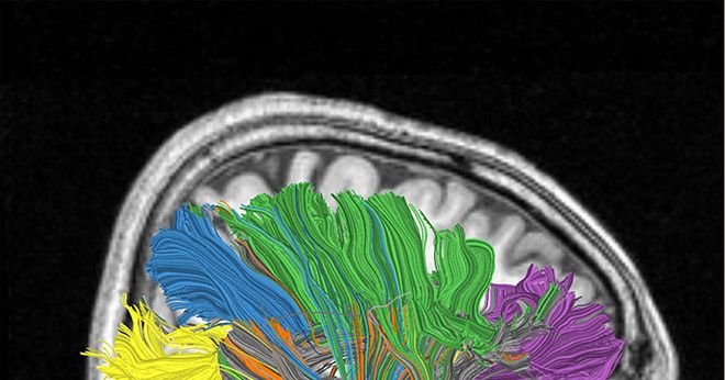 Reverse-Engineering of Human Brain Likely by 2030, Expert Predicts | WIRED