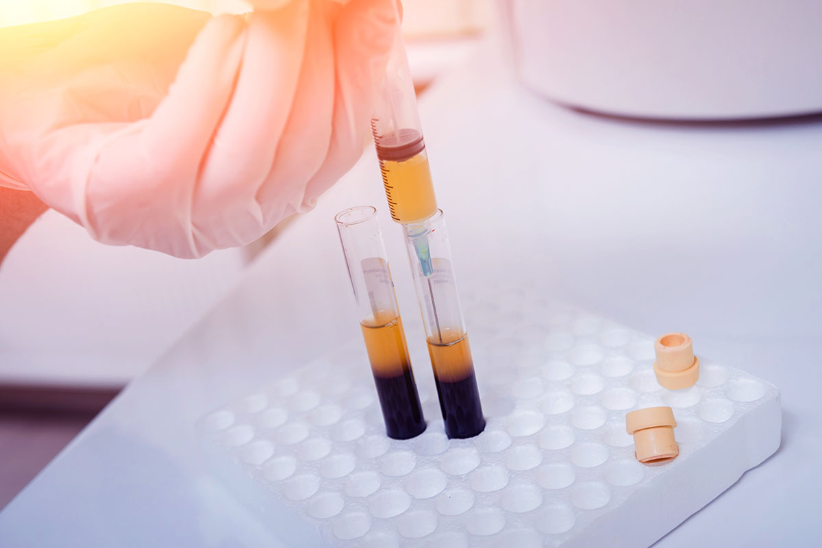 Possible COVID-19 treatment: transfusion of antibodies from recovered patients’ blood – WashU Medicine