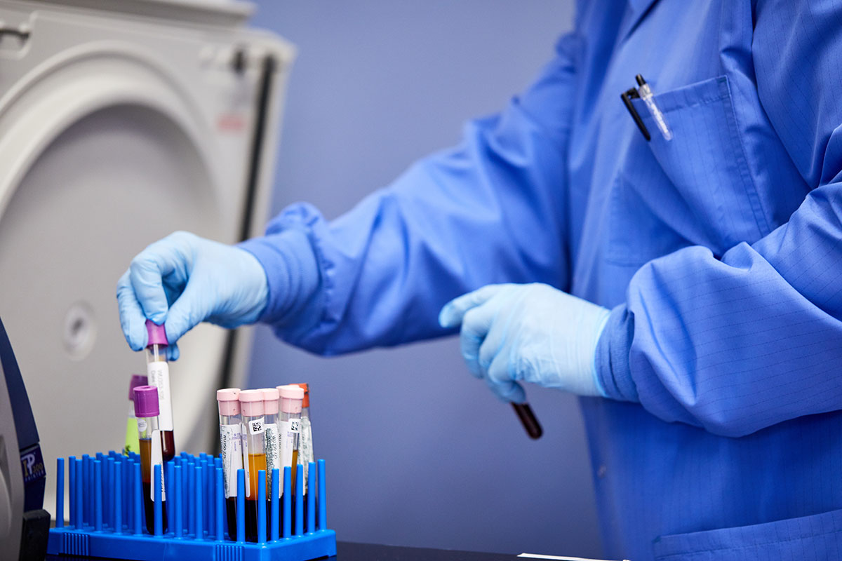 Experts urge caution in interpreting COVID-19 antibody tests – WashU Medicine