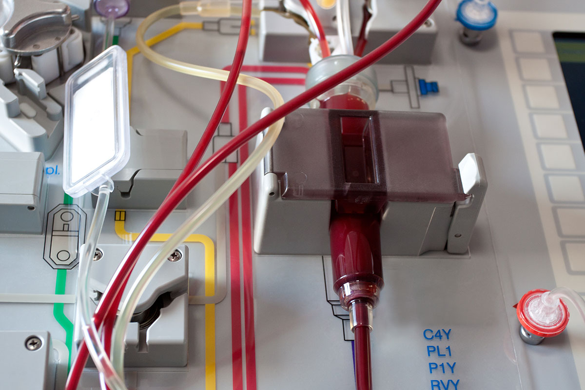 New drug tested to reduce side effect of ‘half-matched’ stem cell transplants – WashU Medicine