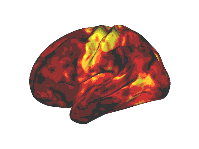 Stimulant ADHD medications work differently than thought – WashU Medicine