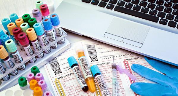 Evaluación de salud mental: Prueba de laboratorio de MedlinePlus