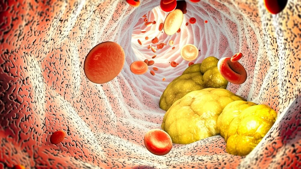 Consejos para combatir el hígado graso - Mejor con Salud