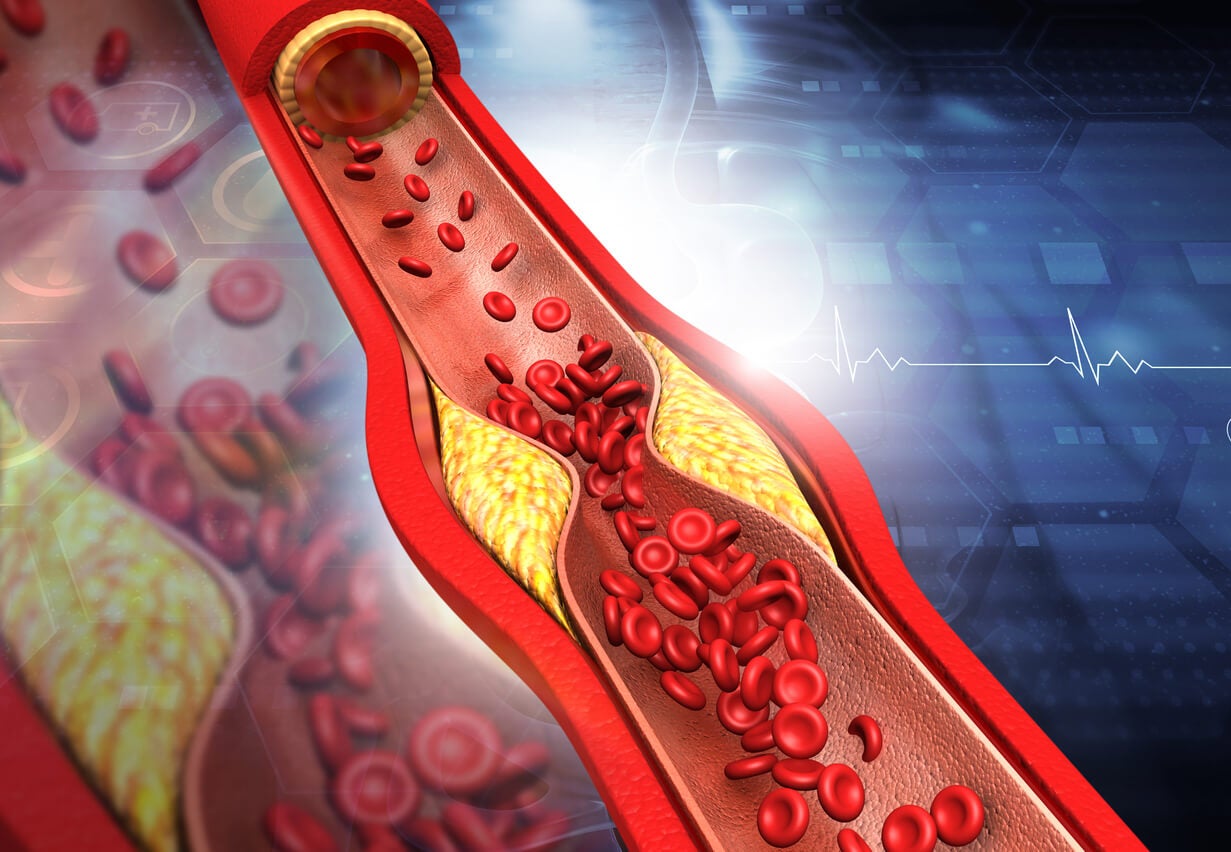 Síntomas y consejos para subir los niveles de colesterol HDL - Mejor con Salud