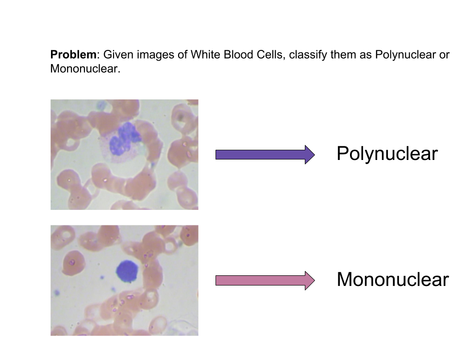 Classifying White Blood Cells With Deep Learning (Code and data included!) | by Dhruv Parthasarathy | Athelas