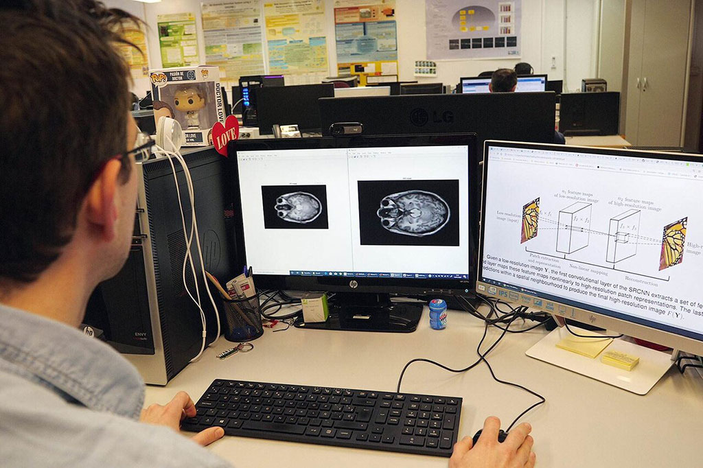 Artificial Intelligence Improves Brain MRI Resolution - MRI - mobile.Medimaging.net