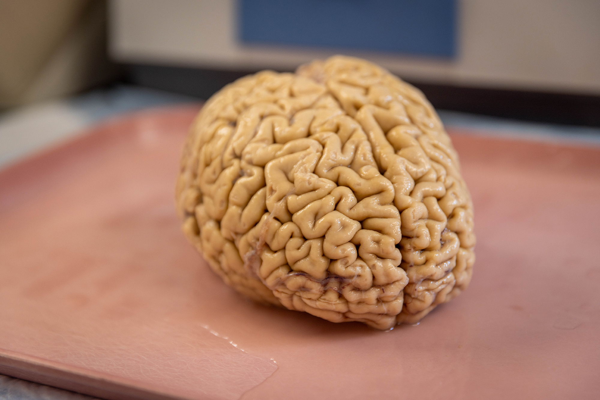 As Superagers Age, They Make at Least Twice as Many New Neurons as Their Peers - News Center