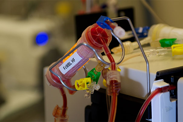 Wyss improves sepsis device — Harvard Gazette