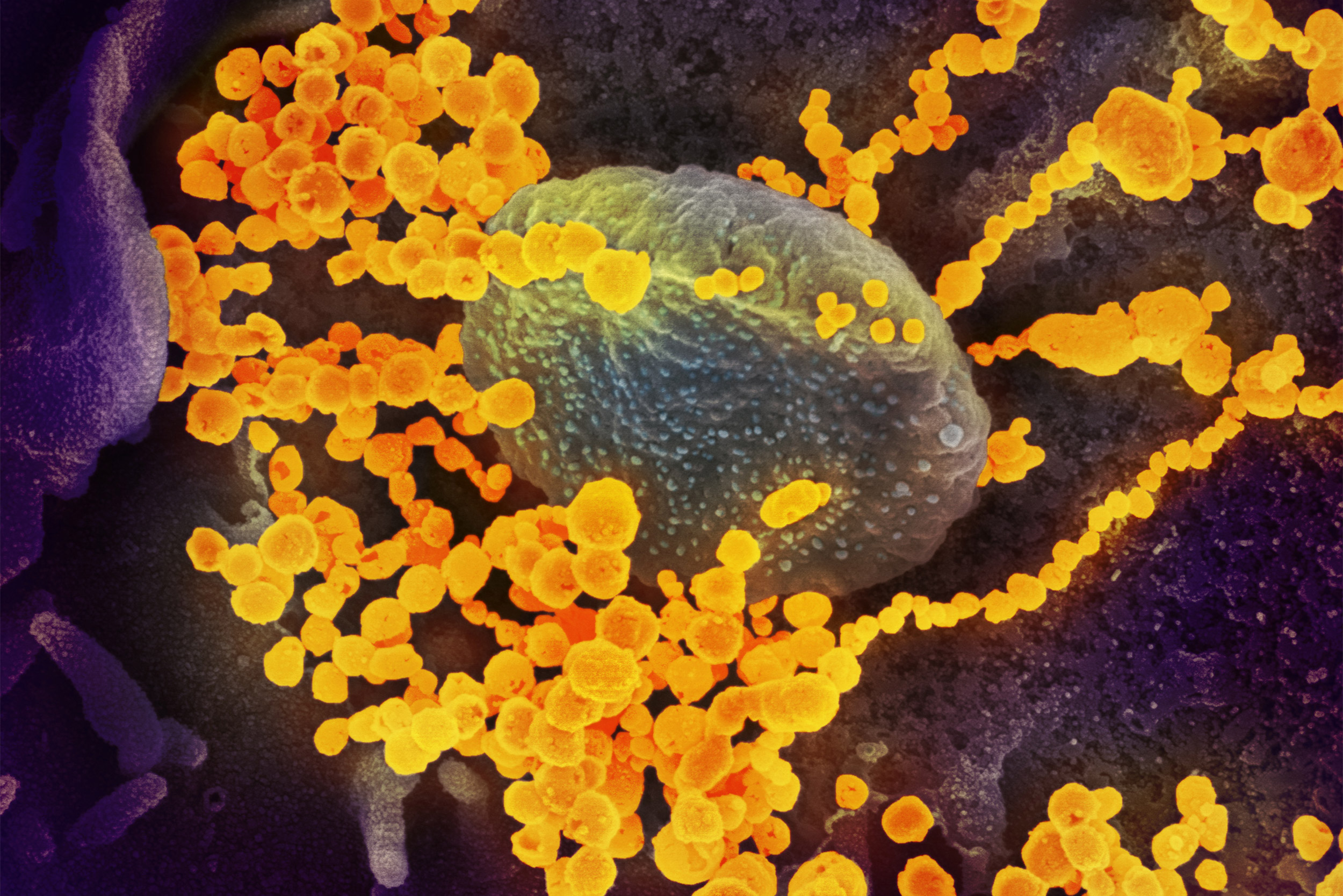 To stem coronavirus crisis, scientists forge ahead on 6 key fronts — Harvard Gazette
