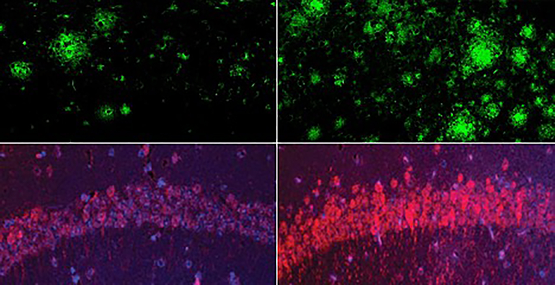 Could lithium explain — and treat — Alzheimer’s? — Harvard Gazette