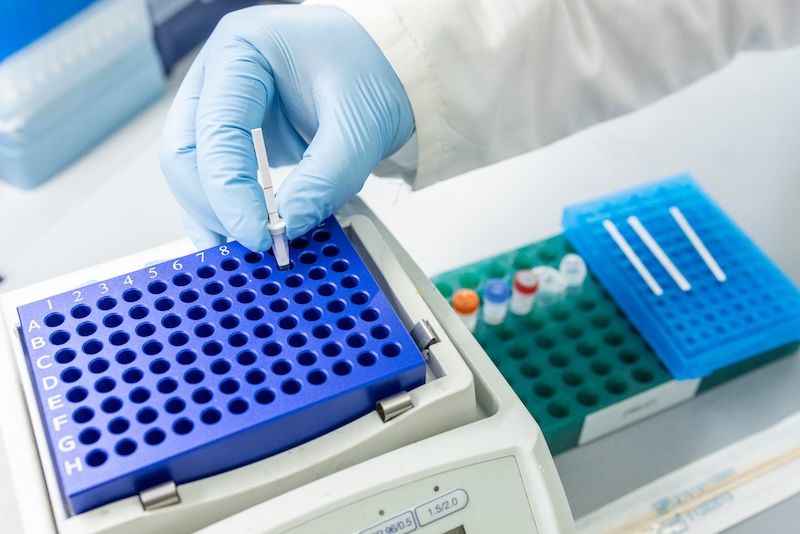 New CRISPR test could make tuberculosis screening as simple as a mouth swab
