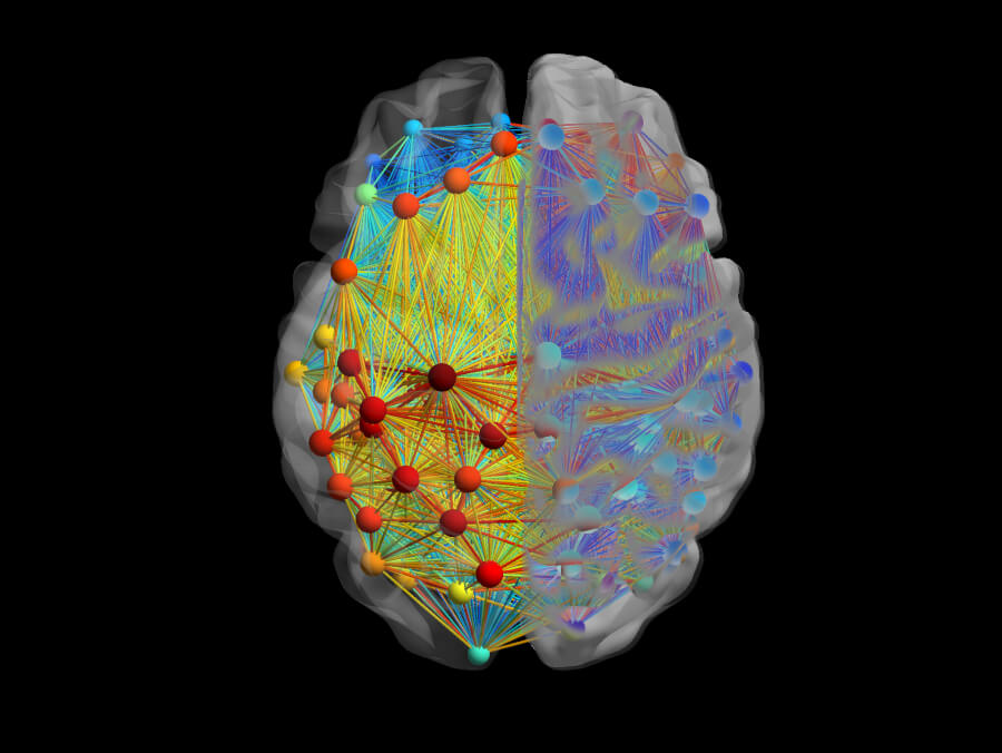 UT Health San Antonio scientist discovers stress-triggered pathway behind migraines - UT Health San Antonio