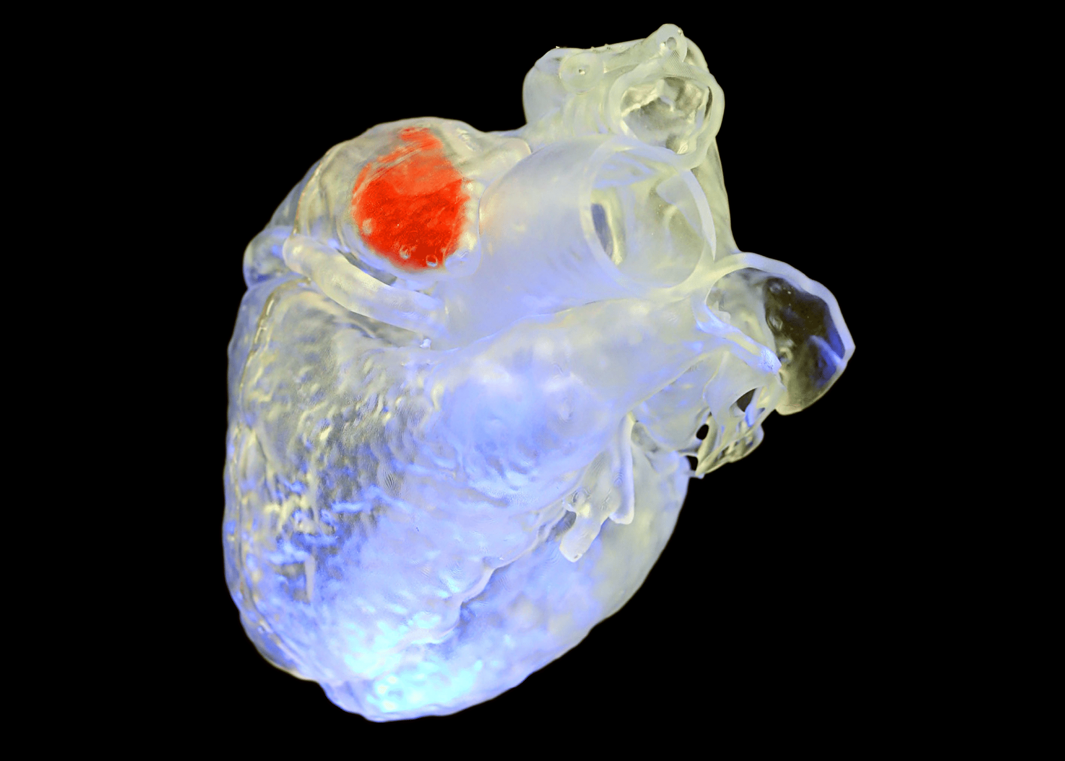 Soundwaves Harden 3D-Printed Treatments in Deep Tissues | Duke Pratt School of Engineering