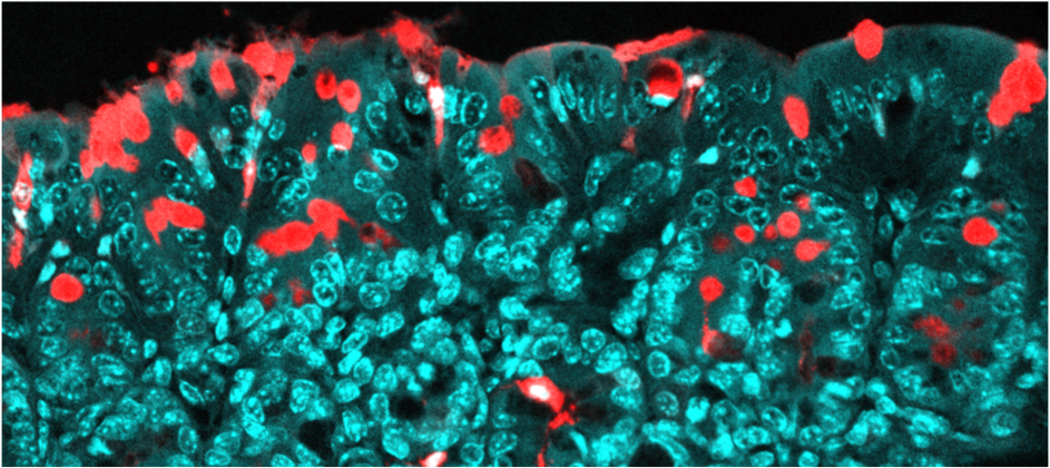 Consommation d’additifs alimentaires pendant la grossesse : des effets sur le microbiote de la descendance favorisant les maladies inflammatoires - Salle de presse de l'Inserm