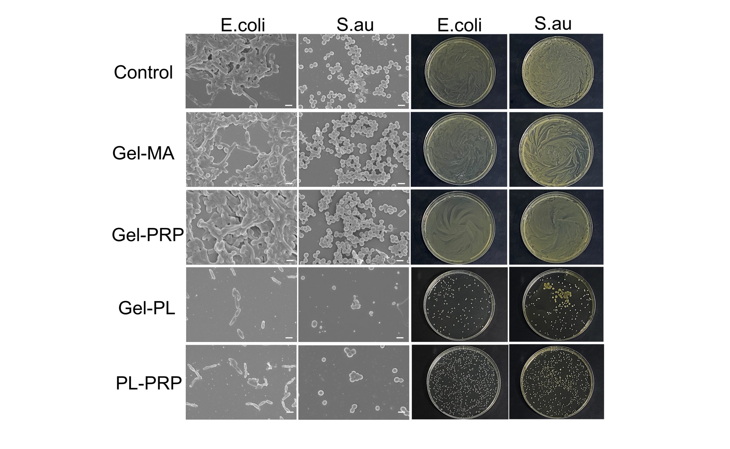 Wound Treatment Gel Fights the Battle Against Antibacterial Resistance - AIP Publishing LLC