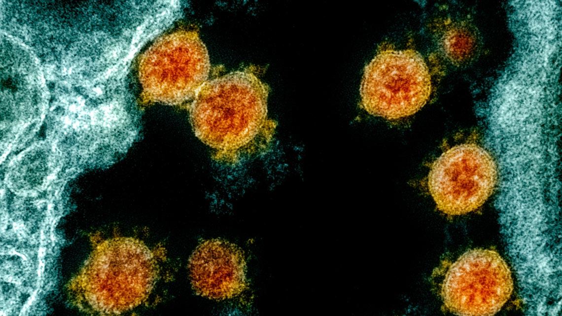 Estudo revela grande variação entre as defesas produzidas por pessoas recuperadas da COVID-19 | Biblioteca FMUSP - Oficial