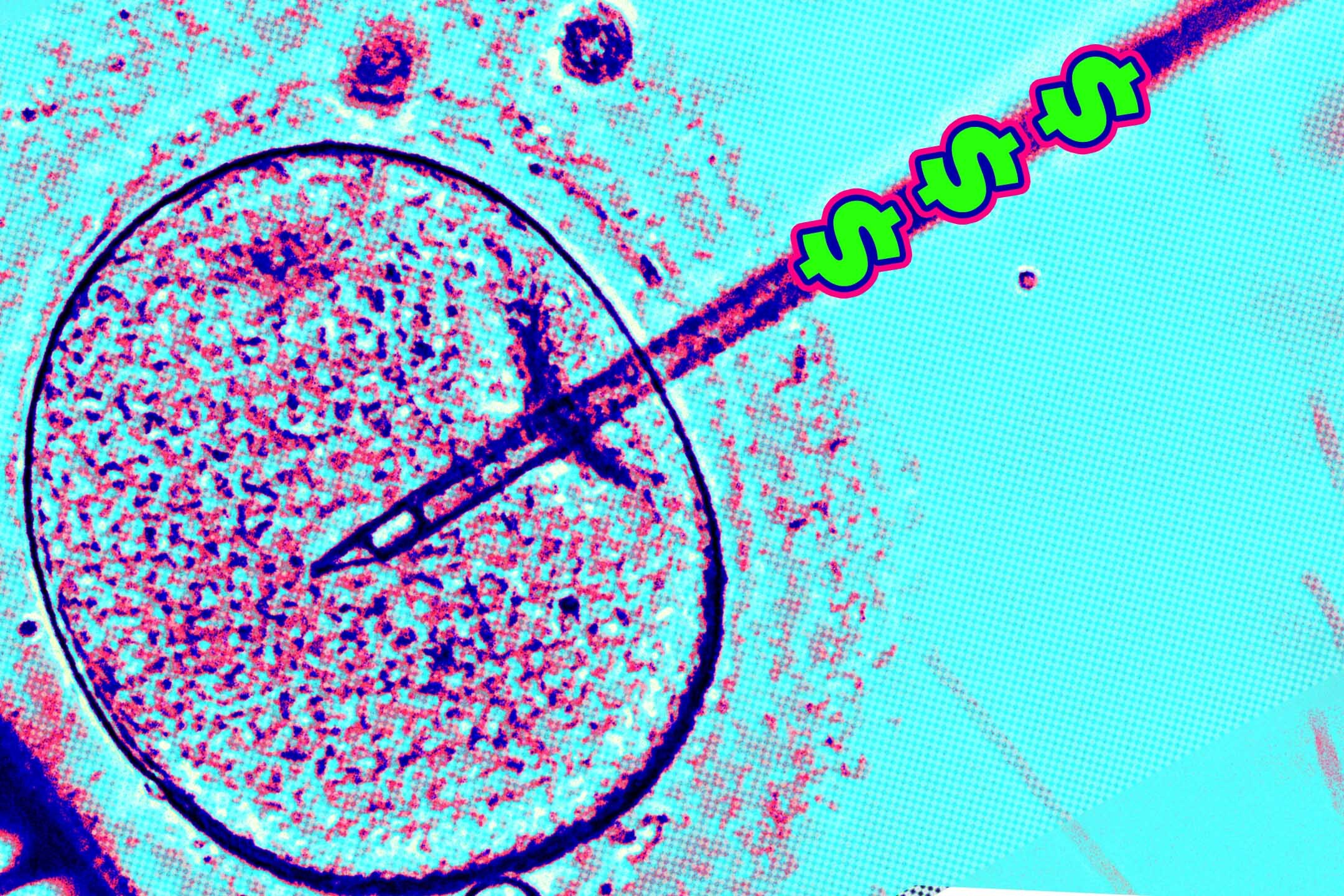 Fertility Clinics See Explosive Growth in Private Equity Money: Study