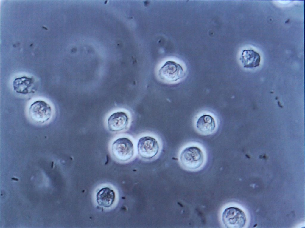 The Infection Schedule versus the Vaccination Schedule | Science-Based Medicine