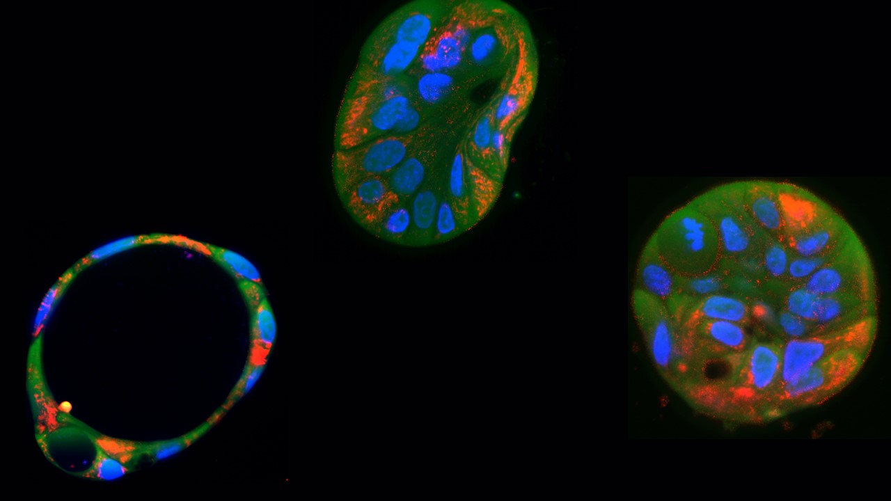 Corrigen mutaciones dañinas en el ADN mitocondrial humano