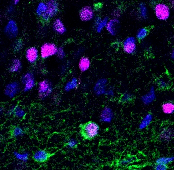 To remember conversations, keep making new brain cells - USC Stem Cell