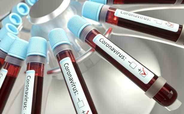 FDA approves rapid coronavirus test with results in 45 minutes. Test to be conducted by California-based diagnostic testing company Cepheid - Tech Startups
