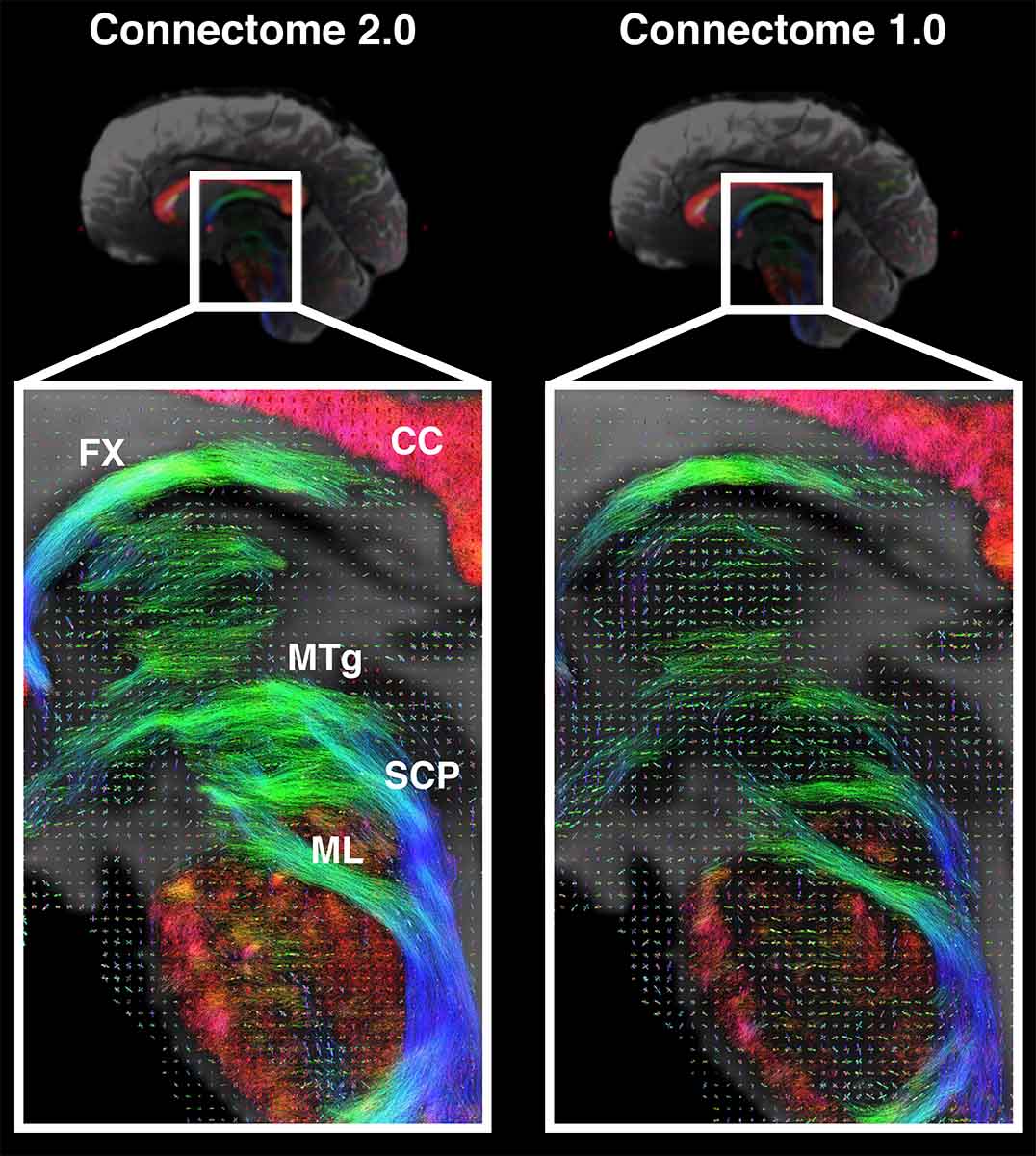 “A Transformative Leap in Brain Imaging”: Innovative MRI System May Produce First Full Brain Connection Map - The Debrief