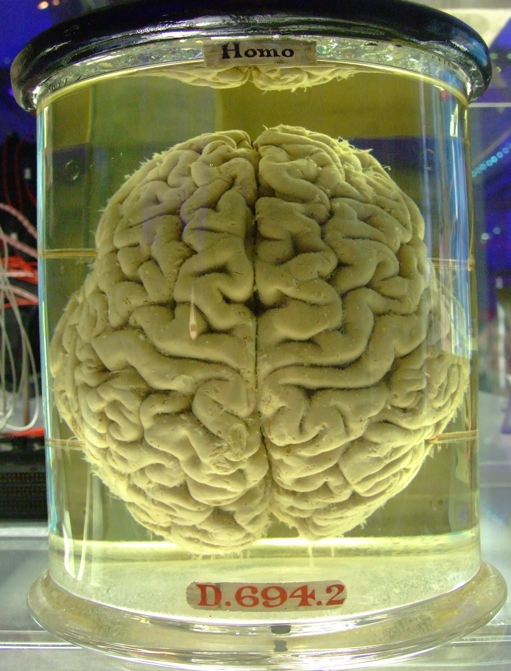 Stories in Formaldehyde: The Strange Pleasures of Taxonomizing Plot - The Millions