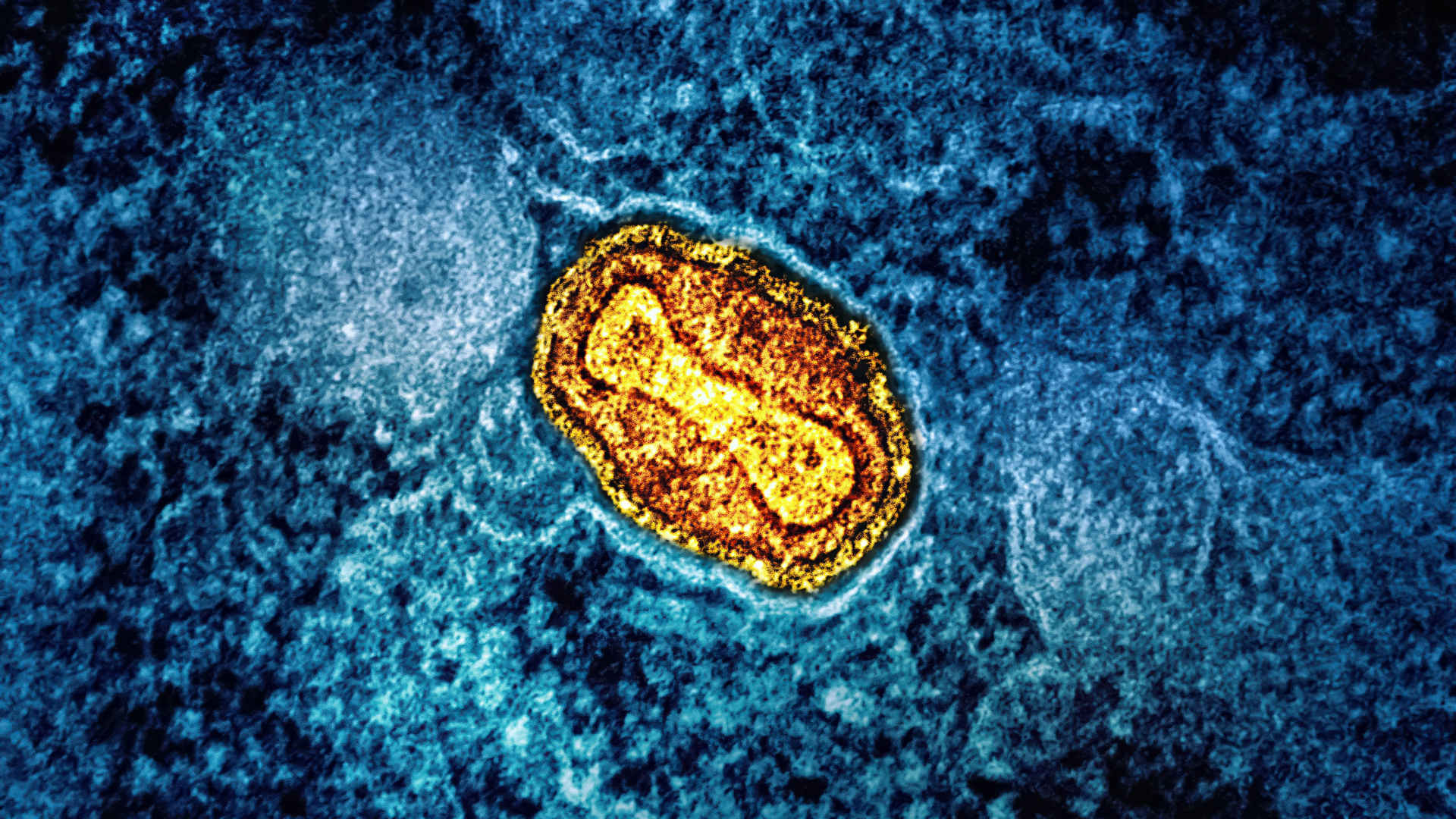 Mpox Offers Another Chance to Confront Vaccine Inequity