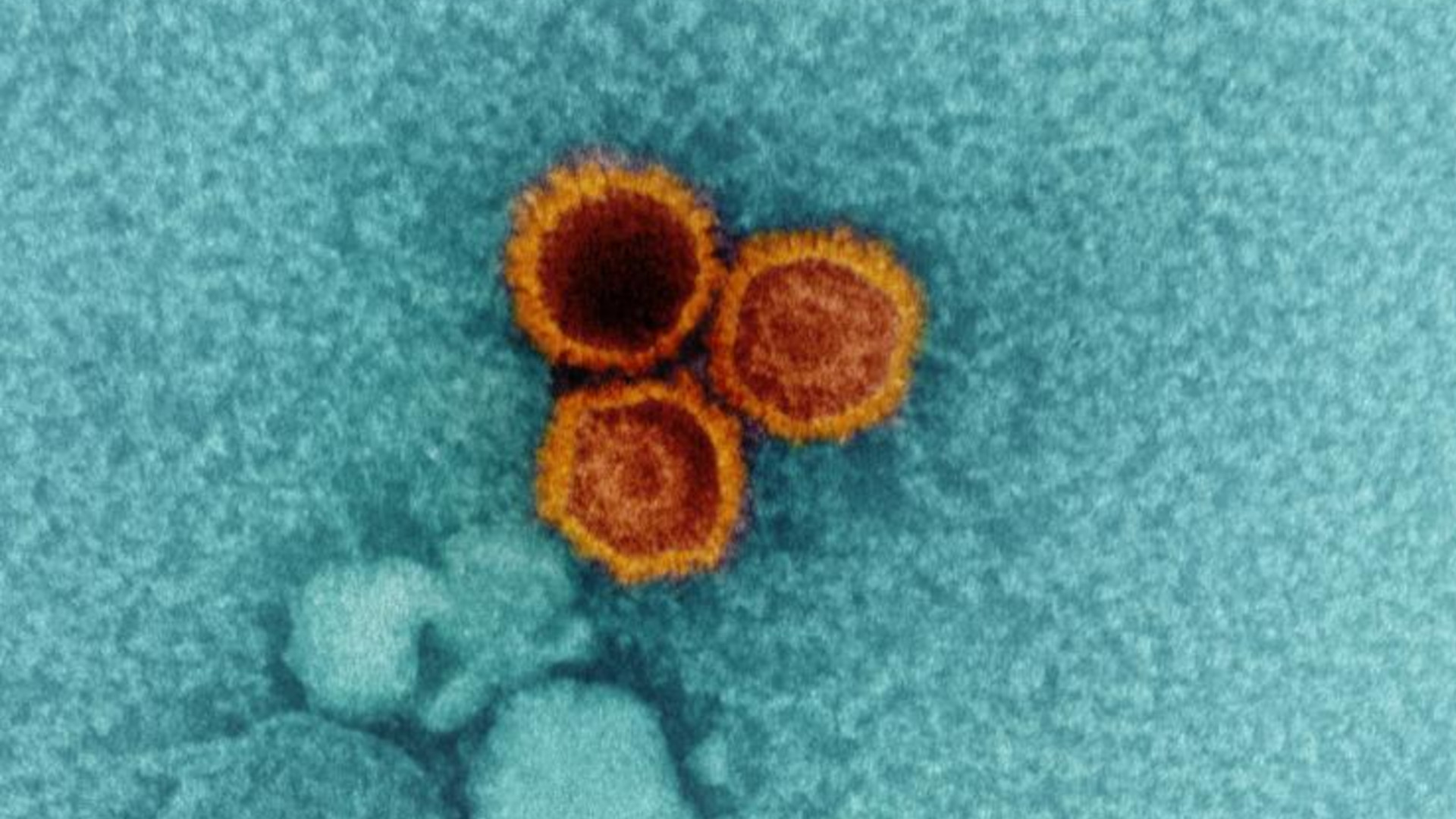 What Anti-Vaccine Policies Could Mean for Autoimmune Diseases