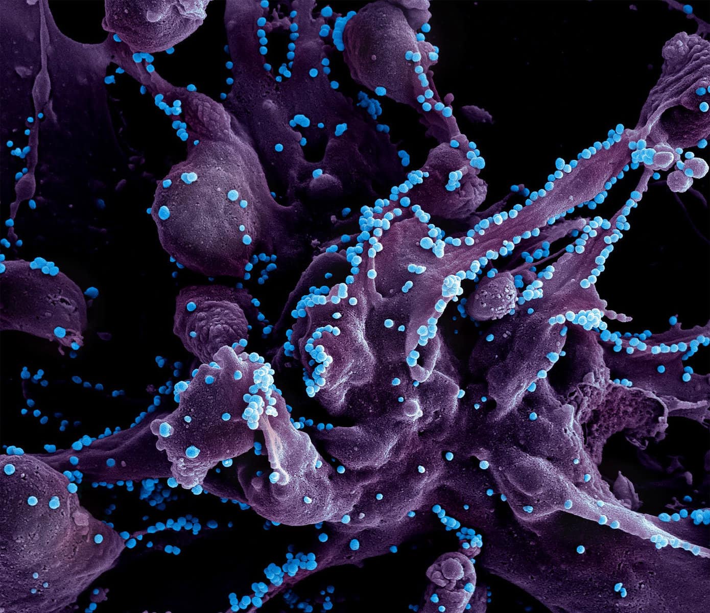 Celebrated virus hunter siphoned taxpayer funds for his 'Global Virome Project'