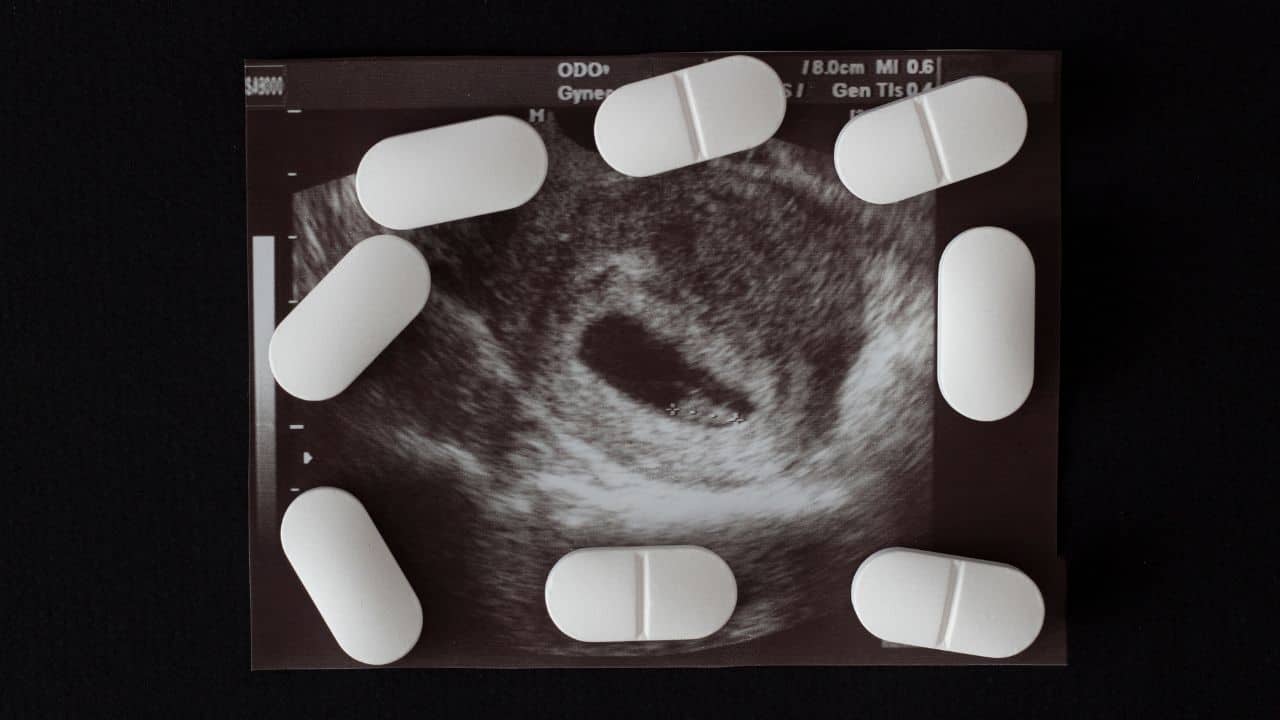 What is the Texas Abortion Law? March 2024 Update