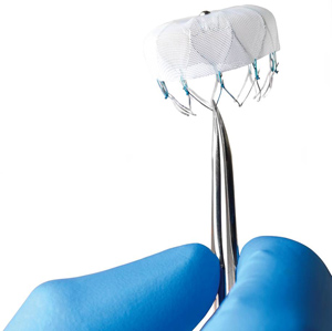 Vanderbilt Heart offers alternative to blood thinners for atrial fibrillation - Vanderbilt Health News