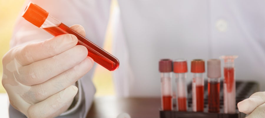 CDC temporarily pauses rabies, pox virus testing | AHA News