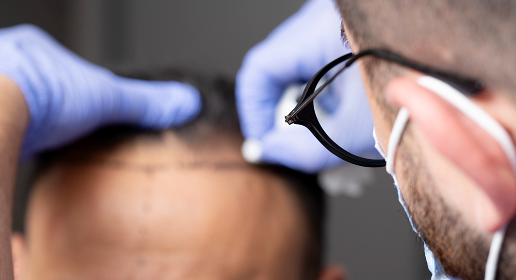 The Risks and Realities of the 'Lineup' or 'Shape-Up' Hairline Trend in Hair Transplant Surgery - American Hair Loss Association