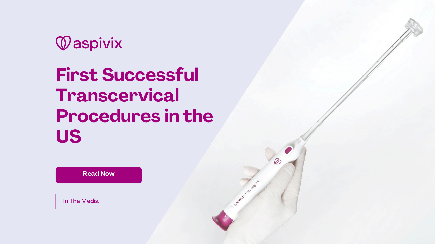 First Successful IUD and Transcervical Procedures with Aspivix’s Non-Traumatic Carevix® Performed in the US - Aspivix