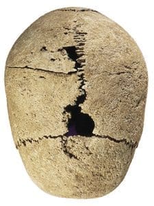 Medicine in the Ancient World - Biblical Archaeology Society