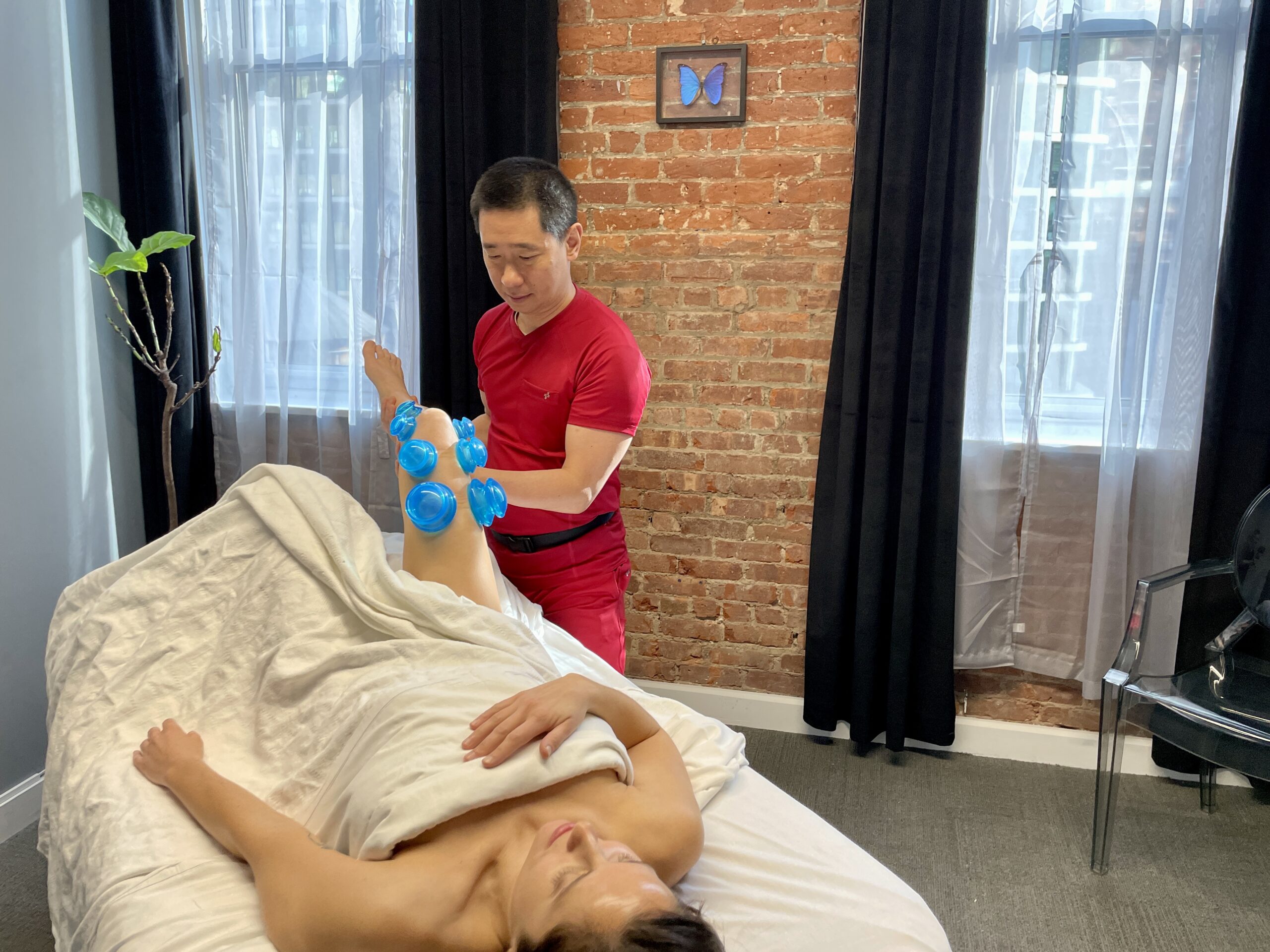 Cupping Therapy in NYC - Body Mechanics Massage