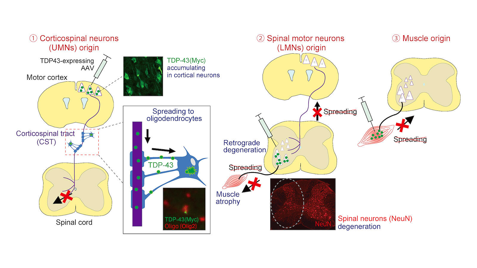 New Insights into the Protein-Mediated Motor Neuron Loss in Amyotrophic Lateral Sclerosis | Research Findings | Brain Research Institute, Niigata University