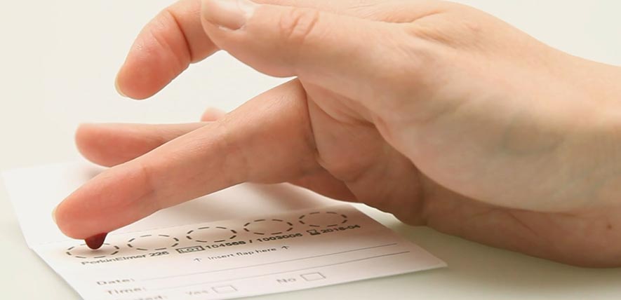 Simple blood test can help diagnose bipolar disorder | University of Cambridge