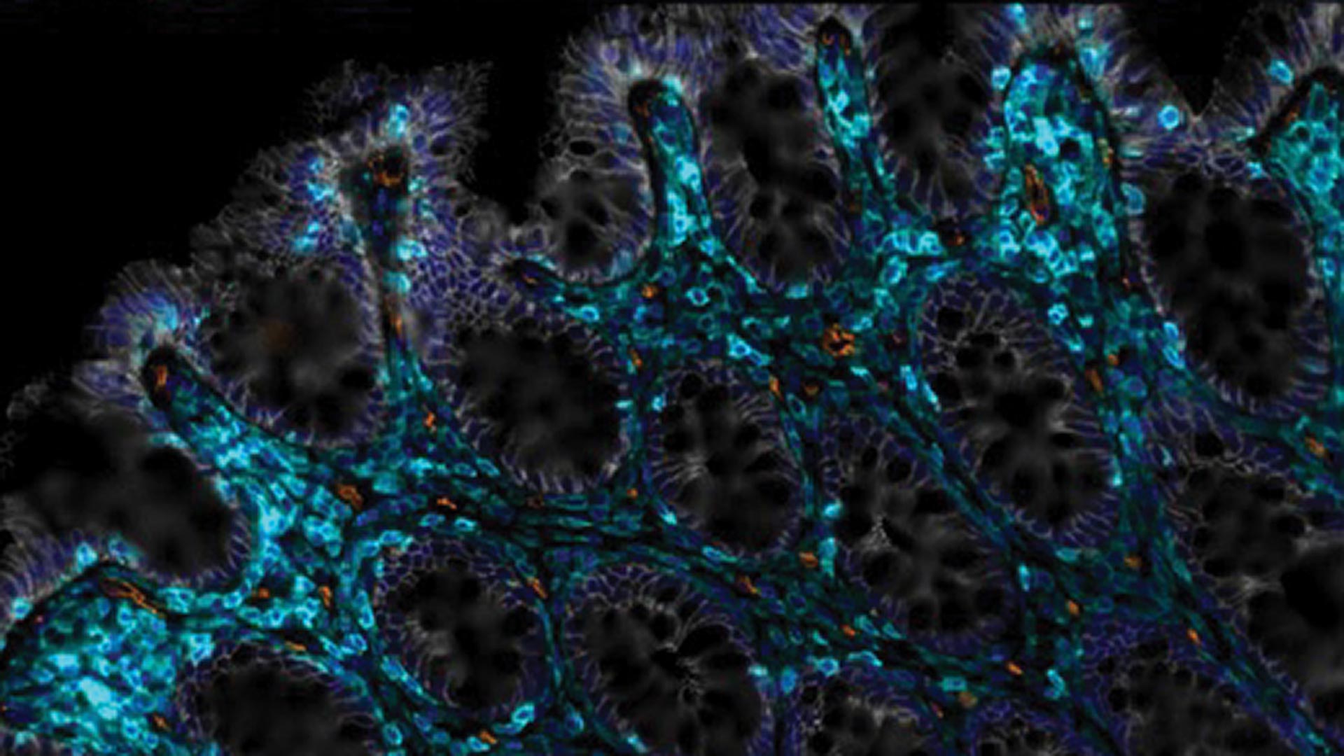 Gut health à la CAR T | Cold Spring Harbor Laboratory