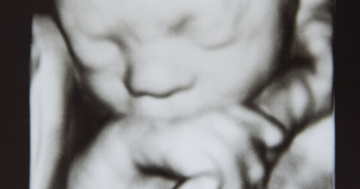 Abortions Were Rising Before Dobbs. The Battle to Lower Them Will Be Fought in the States.