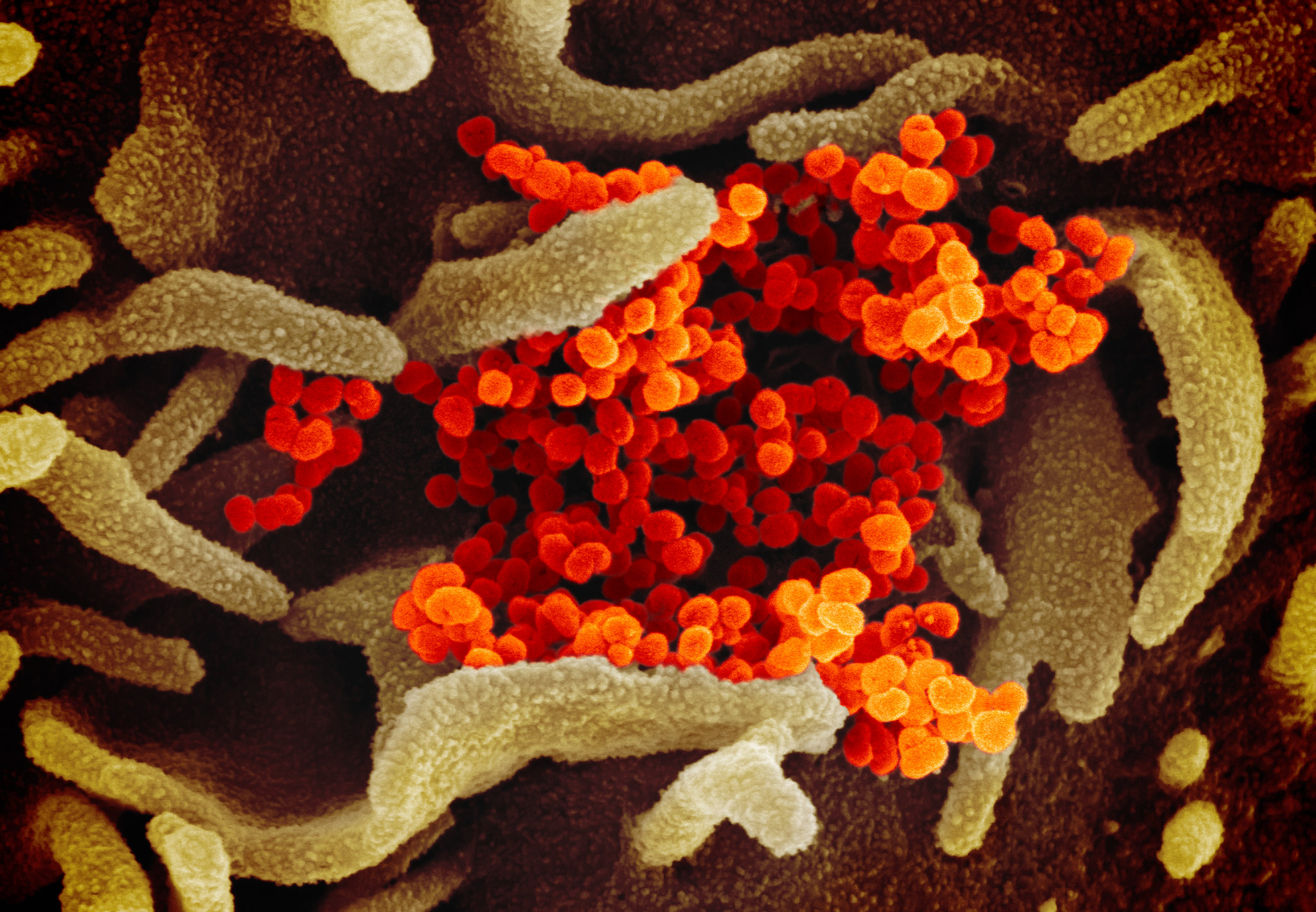 Genentech Launches Phase III Trial of Actemra as Coronavirus Treatment