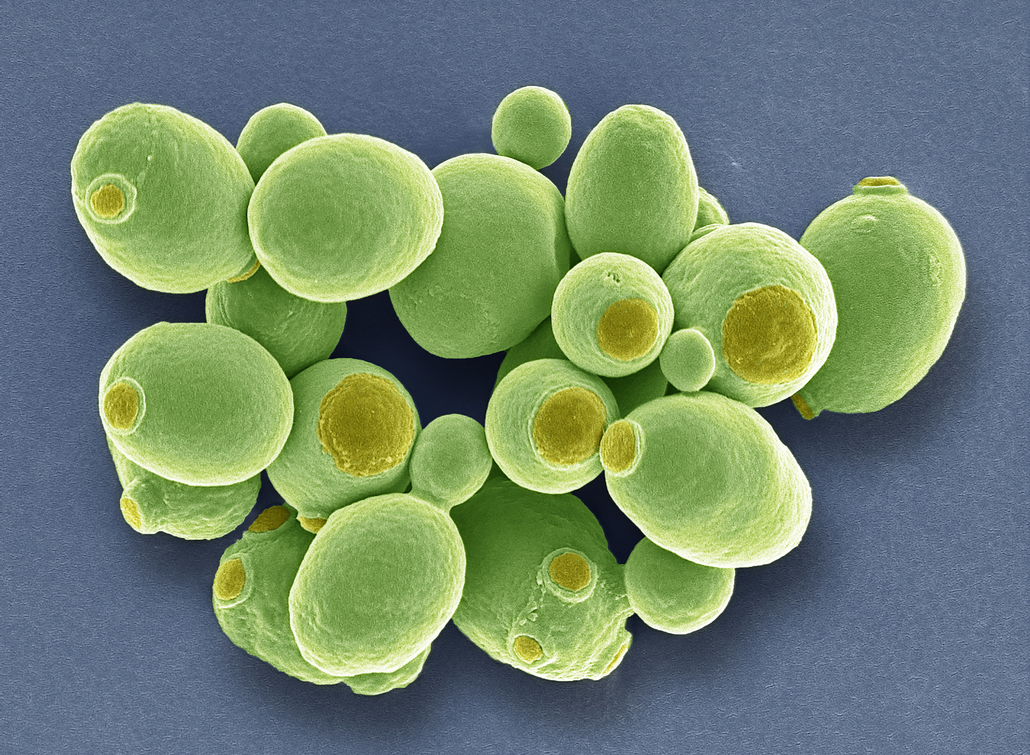 Biosynthesis of Medicarpin in Engineered Yeast