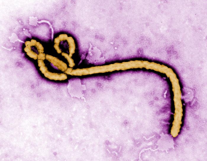 Ebola and Marburg-Induced Gut Damage Modeled Using Organoids