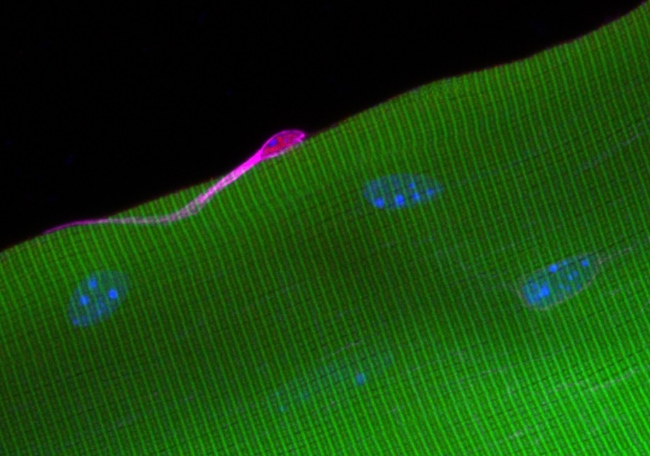 Muscle Stem Cells Bolstered by ECM Protein Tenascin-C
