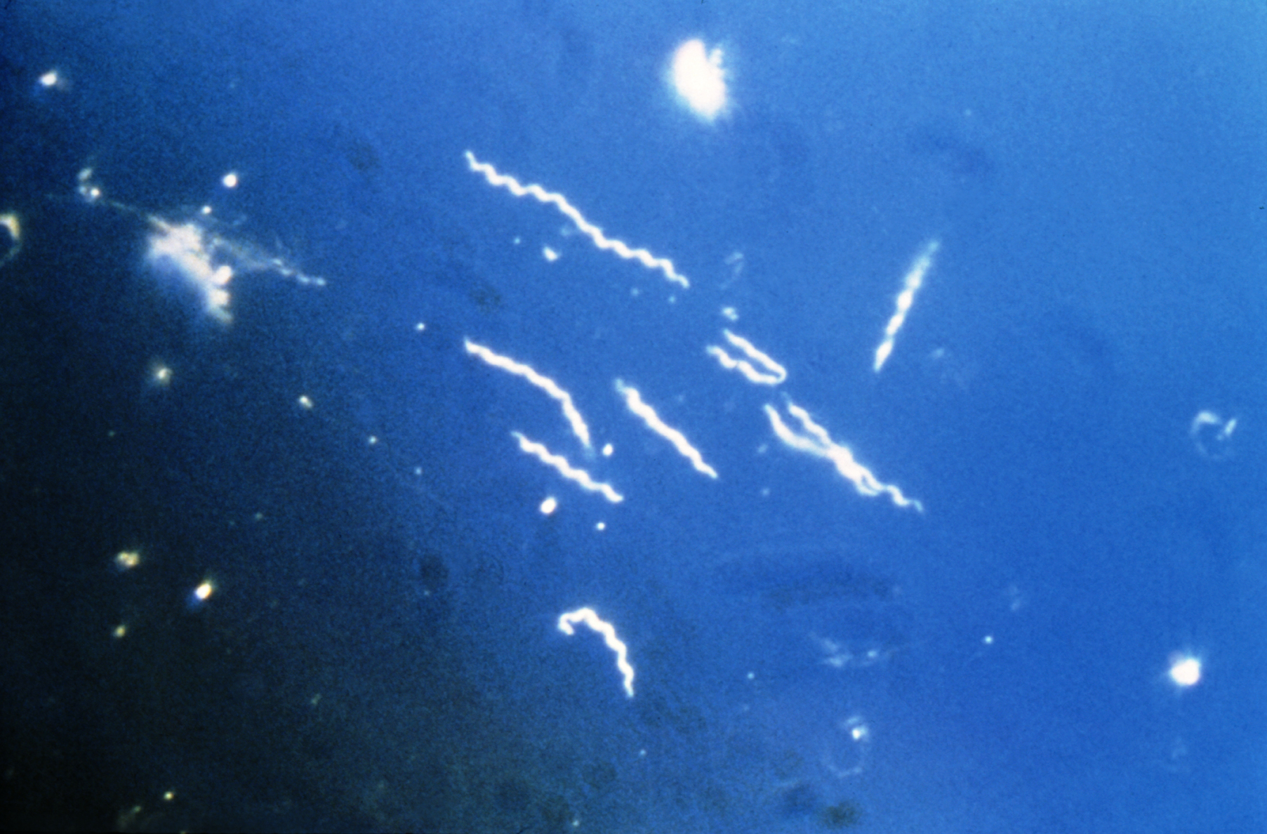 NEWS: Recent study suggests that Lyme disease can be sexually transmitted | LymeDisease.org