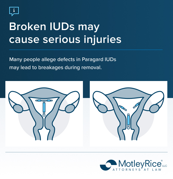 Paragard Lawsuit | February 2026 IUD Lawsuit Updates