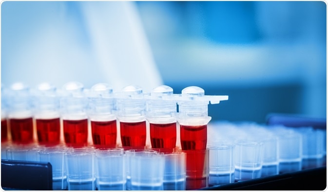 Procalcitonin and Respiratory Tract Infections